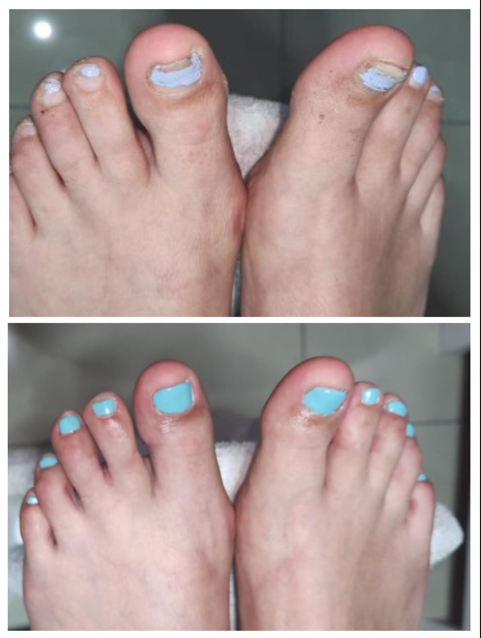 Pedicuria y estetica de pies